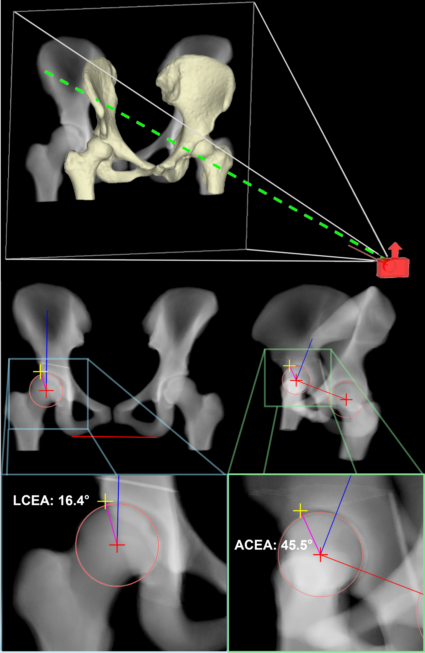 AutomatedMeasurements