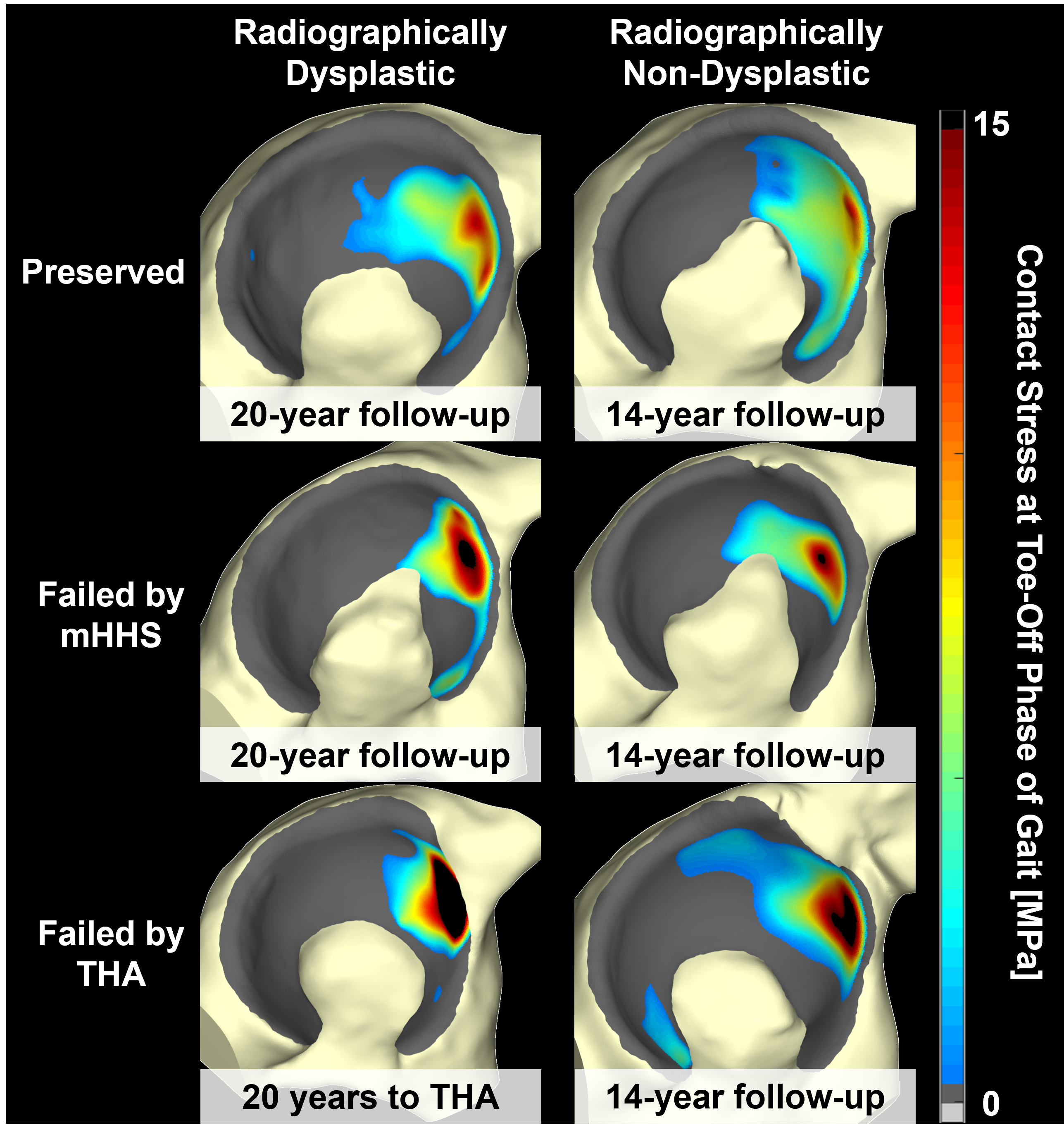 DEAContralateralHips