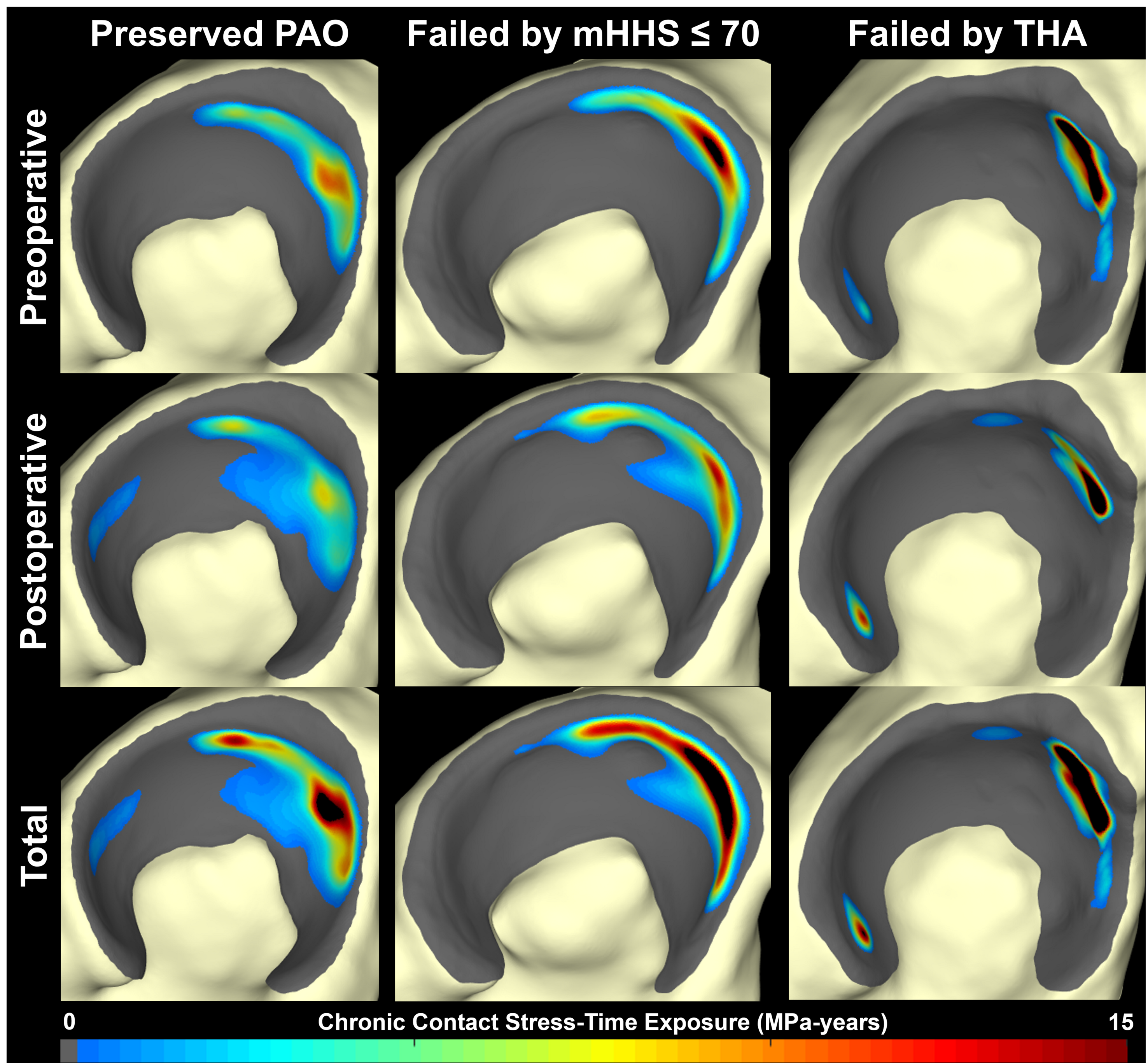 A 3x3 grid of rainbow contour plots of contact stress distributed across surface renderings of an acetabulum