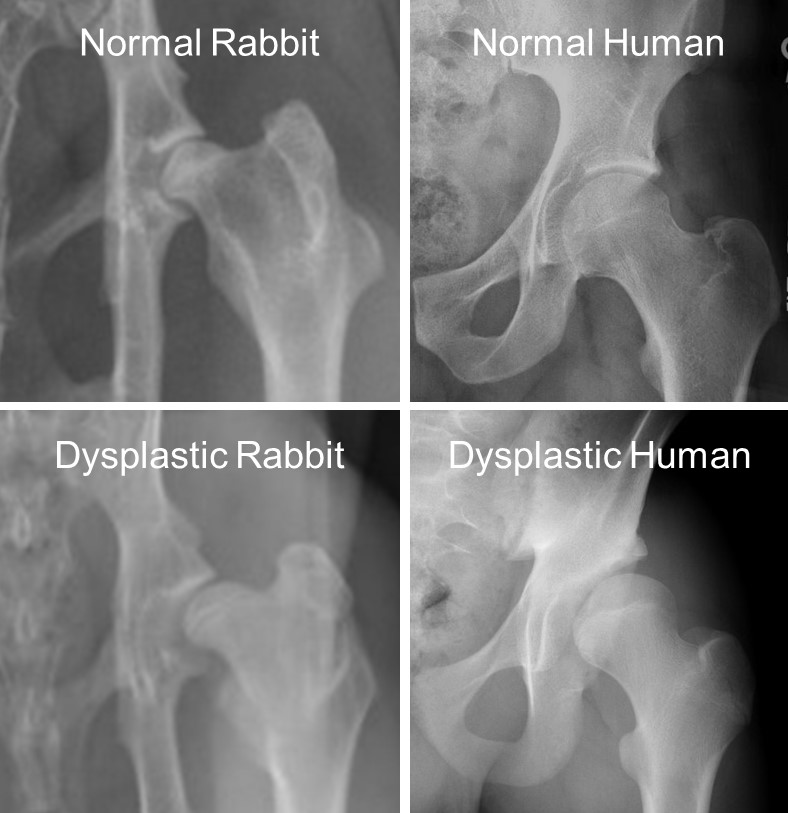 xrays of hips with and without dysplasia