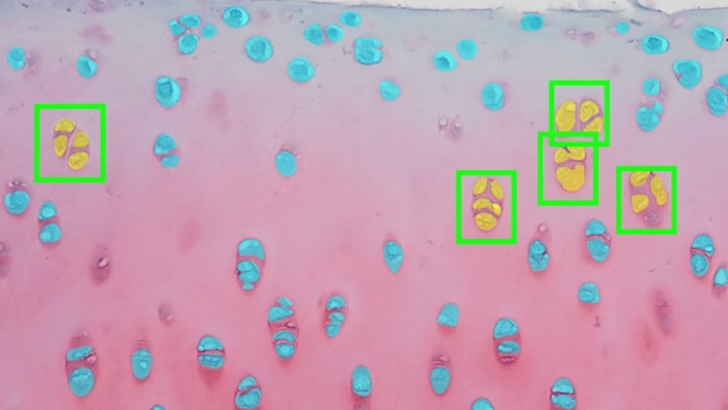 Digitized microscope image of cartilage showing automatically identified cells