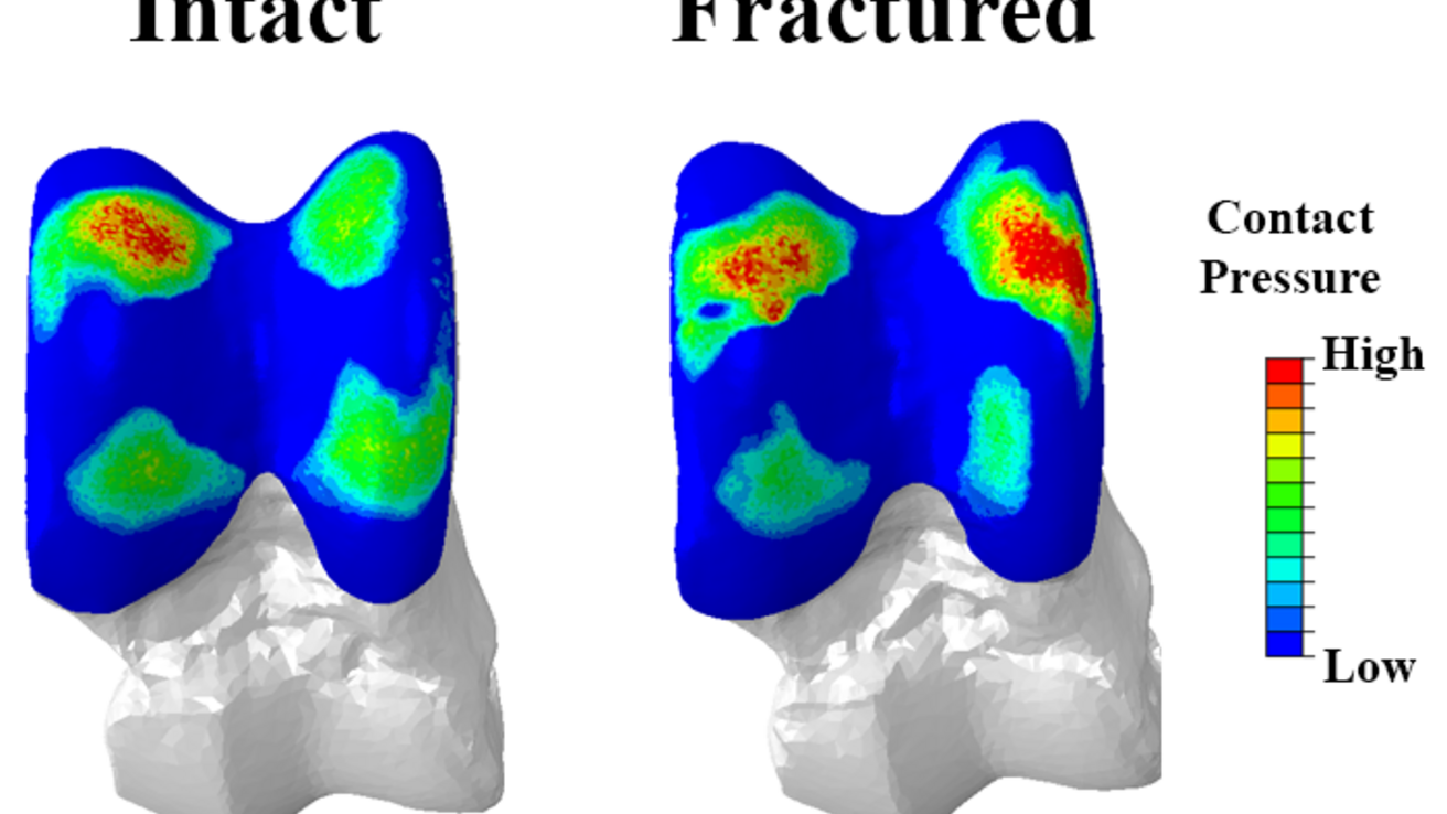 Contact stress distributions plotted on the surface of pig talus